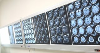 付き添いの重要性と退院後のPET検査結果、放射線治療だけでも完治？